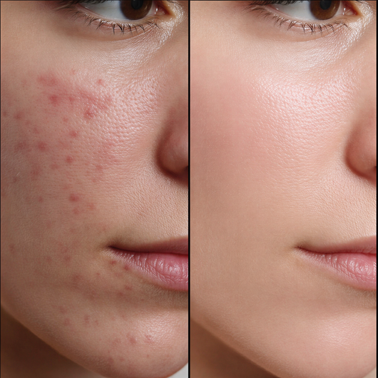 Vyrelle™ Alpha-Arbutin Brightening Hydrogel Mask (Dark Spots & Hyperpigmentation Care)